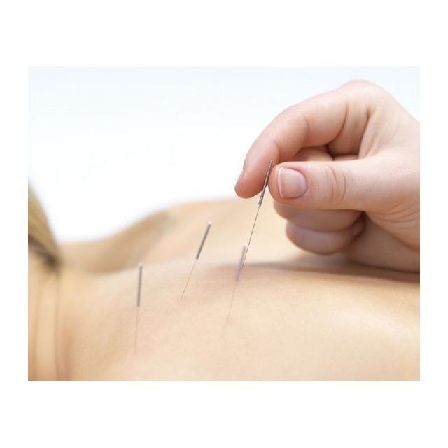 Curso Acupuntura para fisioterapeutas- Madrid Coming soon
