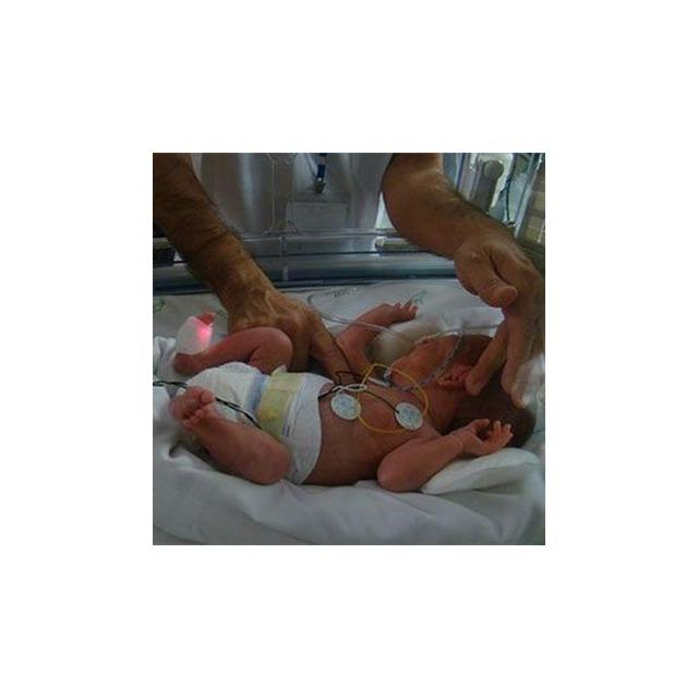 Curso sobre la Intervención terapéutica en el niño prematuro y otros neonatos de riesgo- Finalizado