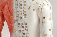 Curso Acupuntura para fisioterapeutas- Madrid Coming soon